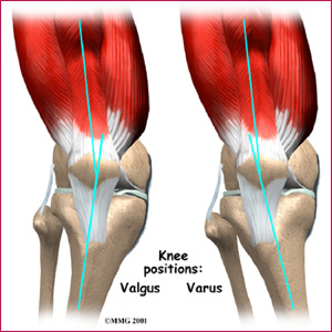 doubleknee.jpg